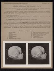 Cranio-Cerebral Topography - no. 2