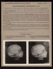 Cranio-Cerebral Topography - no. 3