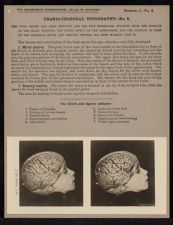 Cranio-Cerebral Topography - no. 5