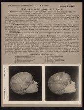 Cranio-Cerebral Topography - no. 6