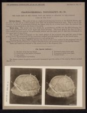 Cranio-Cerebral Topography - no. 10