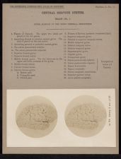 Central Nervous System. Brain - no. 1