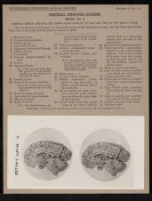 Central Nervous System. Brain - no. 4