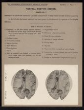 Central Nervous System. Brain - no. 7