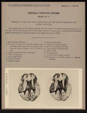 Central Nervous System. Brain - no. 9