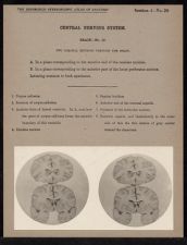 Central Nervous System. Brain - no. 10