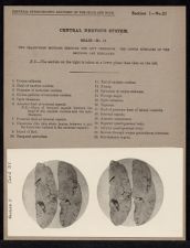 Central Nervous System. Brain - no. 11