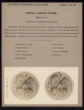 Central Nervous System. Brain - no. 12