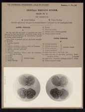 Central Nervous System. Brain - no. 14