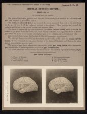 Central Nervous System. Brain - no. 15