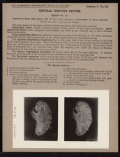 Central Nervous System. Brain - no. 16