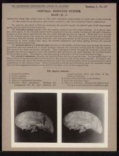 Central Nervous System. Brain - no. 17