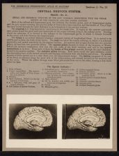 Central Nervous System. Brain - no. 21