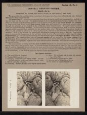 Central Nervous System. Brain - no. 23