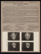 Central Nervous System. Brain - no. 24