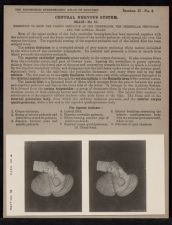 Central Nervous System. Brain - no. 25