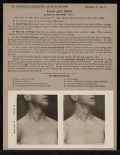 Head and Neck. Surface Anatomy - no. 1