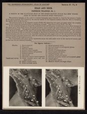 Head and Neck. Posterior Triangle - no. 1