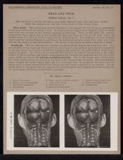 Head and Neck. Spinal Canal - no. 2