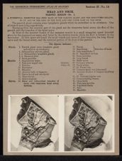 Head and Neck. Parotid Region - no. 1