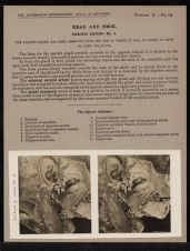 Head and Neck. Parotid Region - no. 2