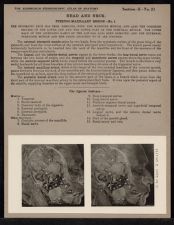 Head and Neck. Pterygo-Maxillary Region - no. 1