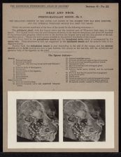 Head and Neck. Pterygo-Maxillary Region - no. 2