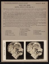 Head and Neck. Sagittal Section of the Head - no. 1