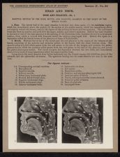 Head and Neck. Nose and Pharynx - no. 1