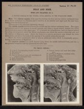 Head and Neck. Nose and Pharynx - no. 2