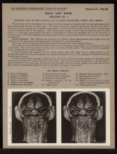 Head and Neck. Pharynx - no. 1