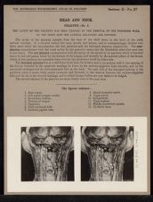 Head and Neck. Pharynx - no. 2