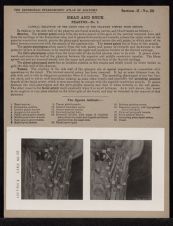 Head and Neck. Pharynx - no. 3