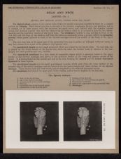 Head and Neck. Larynx - no. 1