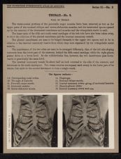 Thorax - no. 3