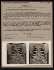 Thorax - no. 10