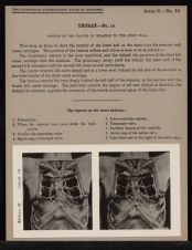 Thorax - no. 14