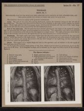 Thorax. Back - no. 2