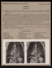 Thorax. Back - no. 4