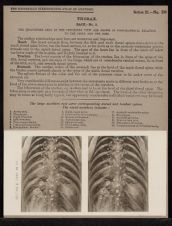 Thorax. Back - no. 5