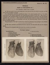 Thorax. Heart and Pericardium - no. 1