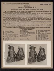 Thorax. Heart and Pericardium - no. 2