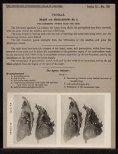 Thorax. Heart and Pericardium - no. 3