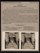 Thorax. Heart and Pericardium - no. 10