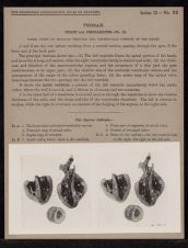 Thorax. Heart and Pericardium - no. 12