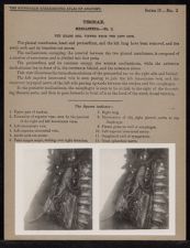 Thorax. Mediastina - no. 2