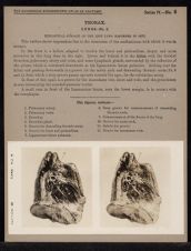 Thorax. Lungs - no. 2