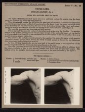 Upper Limb. Surface Anatomy - no. 1