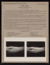 Upper Limb. Surface Anatomy - no. 5