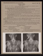Upper Limb. Back - no. 1